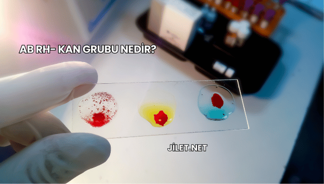 AB Rh- Kan Grubu Nedir?