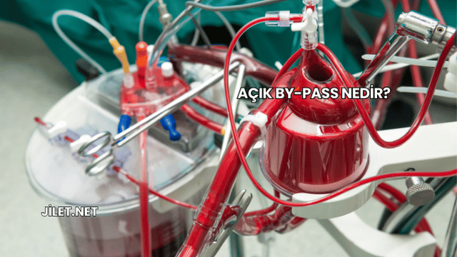 Açık By-Pass Nedir?