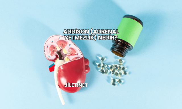 Addison (Adrenal Yetmezlik) Nedir?