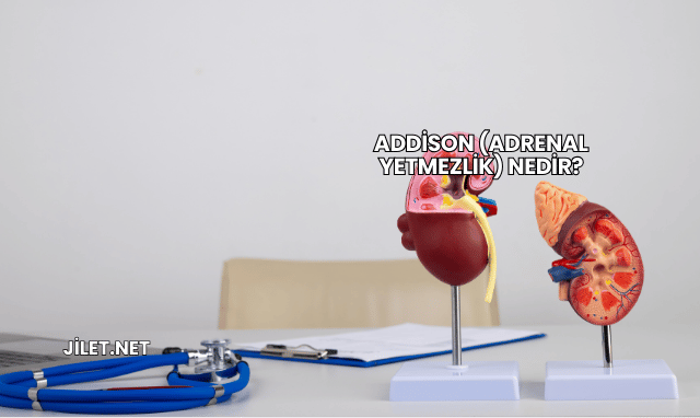 Addison (Adrenal Yetmezlik) Nedir?