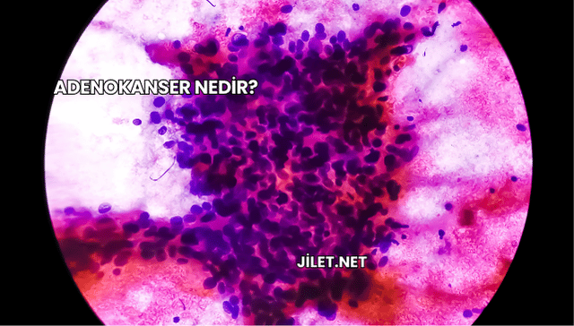 Adenokanser Nedir?