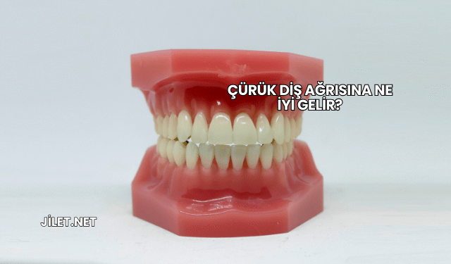 Çürük Diş Ağrısına Ne İyi Gelir?
