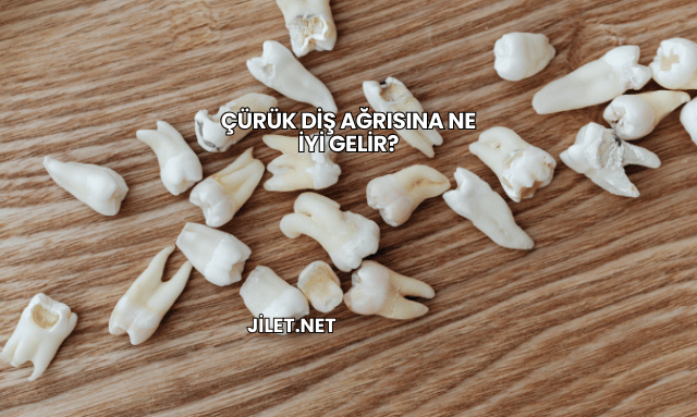 Çürük Diş Ağrısına Ne İyi Gelir?
