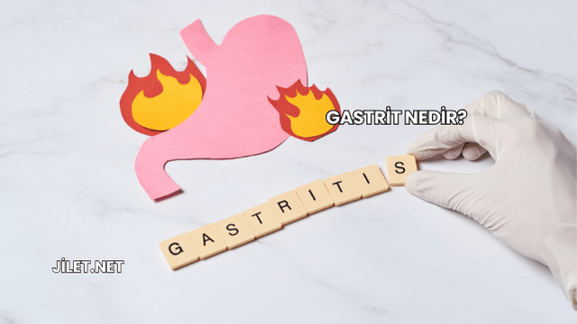Gastrit Nedir?