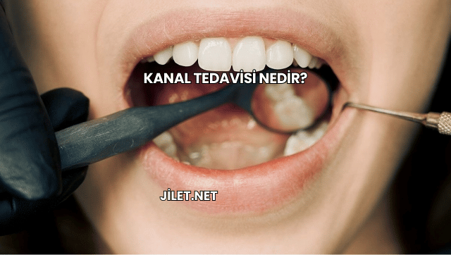 Kanal Tedavisi Nedir?